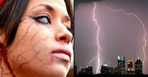 lightning struck victims.